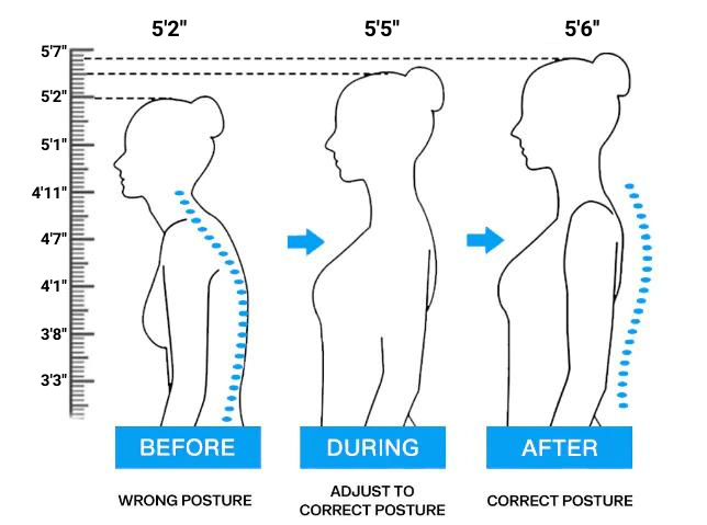 Posture Fix™ LUMI